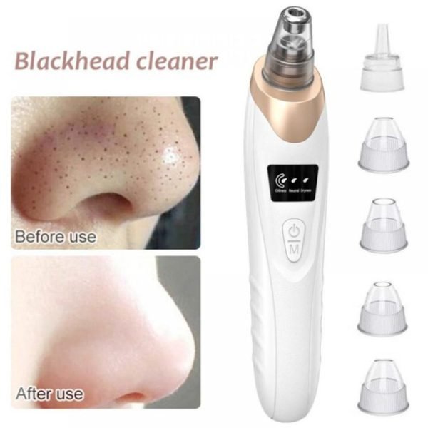 5 in 1 Blackhead Remover - GM Collections